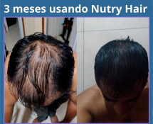 3-meses-usando-Nutry-Hair-3.webp