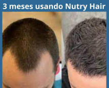 6-meses-usando-Nutry-Hair-1.webp
